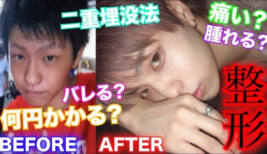 【二重】整形についての質問が多かったから全部リアルに答えました
